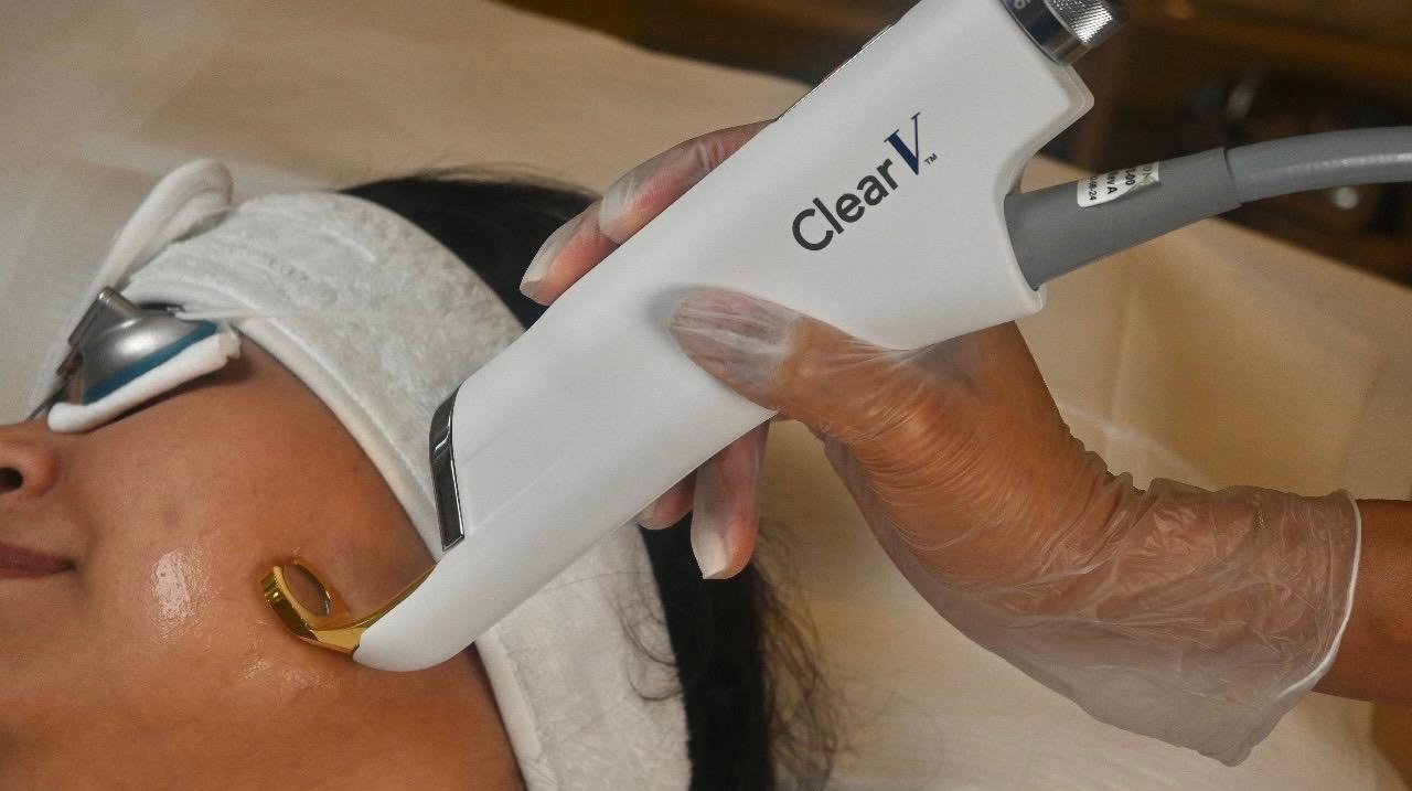 ClearV – Sciton Lasers